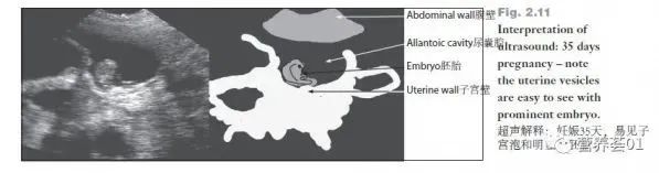 如何正确使用B超进行妊娠检查