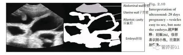 如何正确使用B超进行妊娠检查