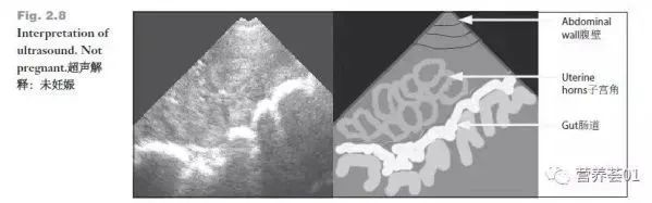 如何正确使用B超进行妊娠检查