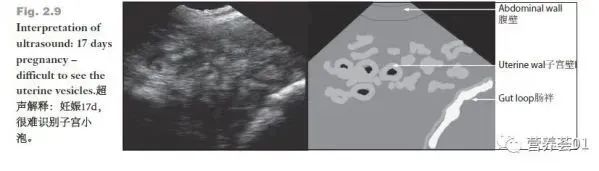 如何正确使用B超进行妊娠检查