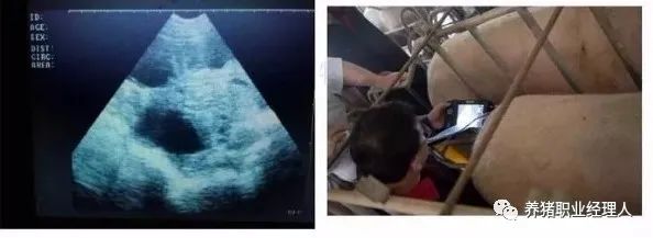 如何正确使用B超进行妊娠检查