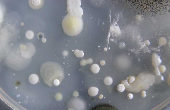 放线菌属于细菌吗？