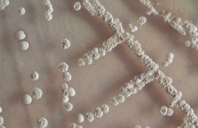 放线菌属于细菌吗？