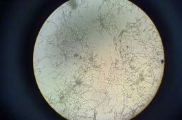 放线菌属于细菌吗？